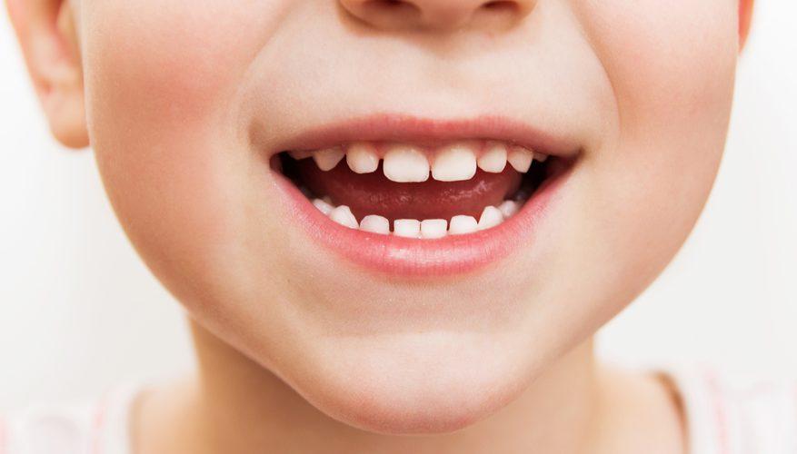 Dantų gydymas miegant – sprendimas vaikams ir suaugusiems