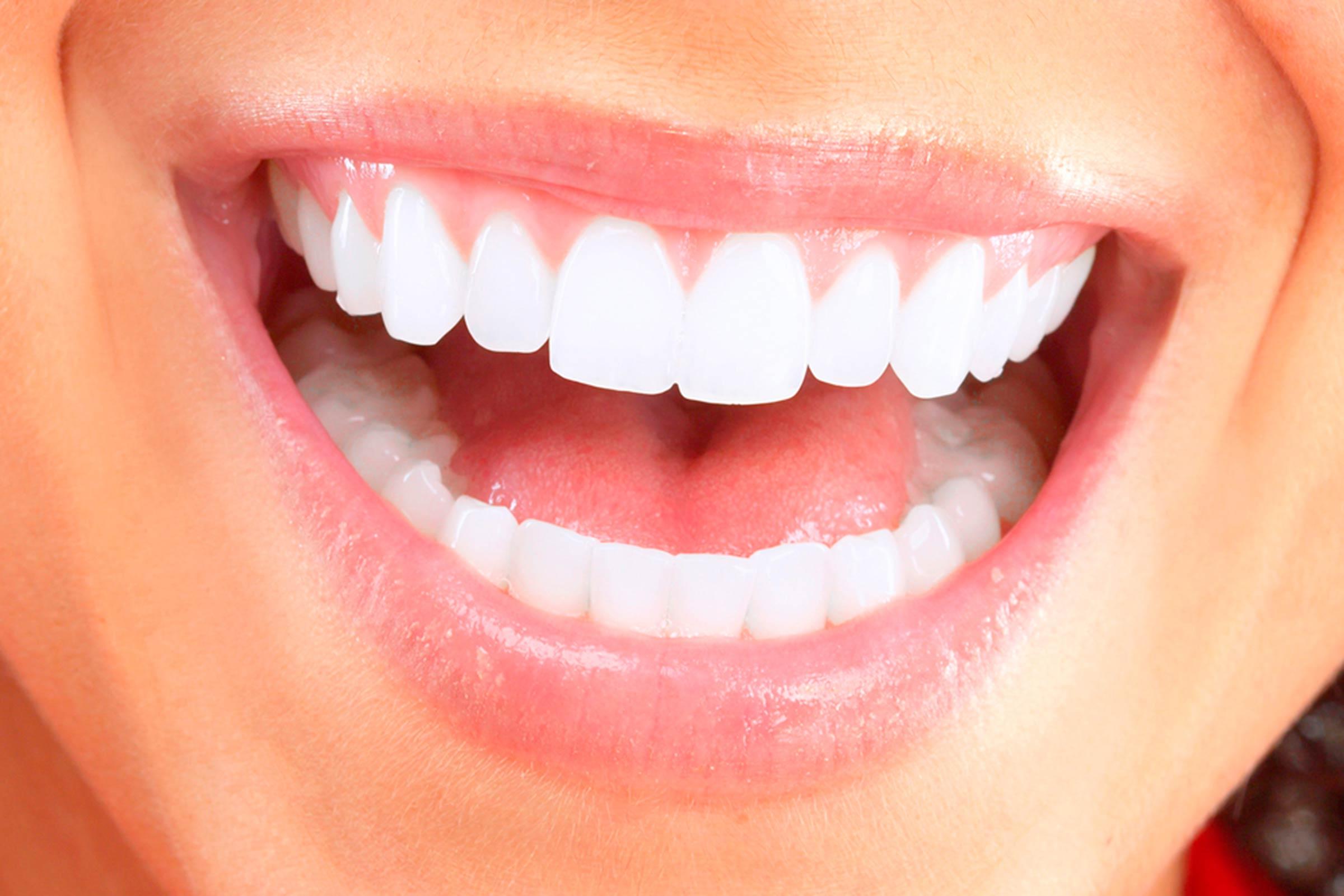 Dantų implantai: kuo jie naudingi ir kaip prižiūrėti /