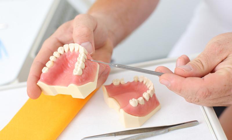 Dantų protezavimo kaina – gana dažnai ieškoma informacija /