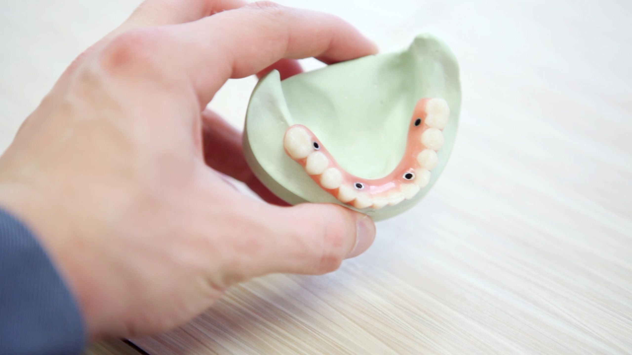 Kodėl verta rinktis dantų implantus? /