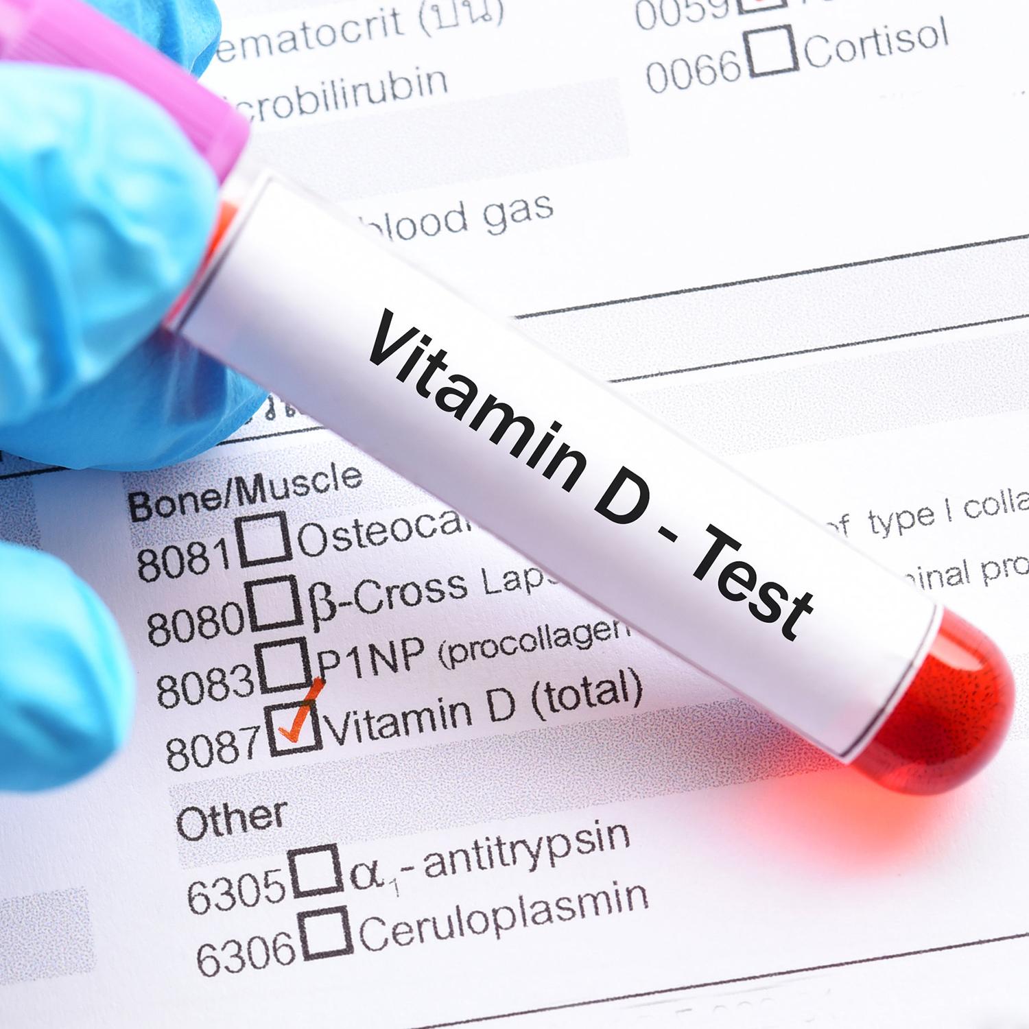 Kraujo tyrimas nebūtinai parodo tikrąjį vitamino D poreikį /